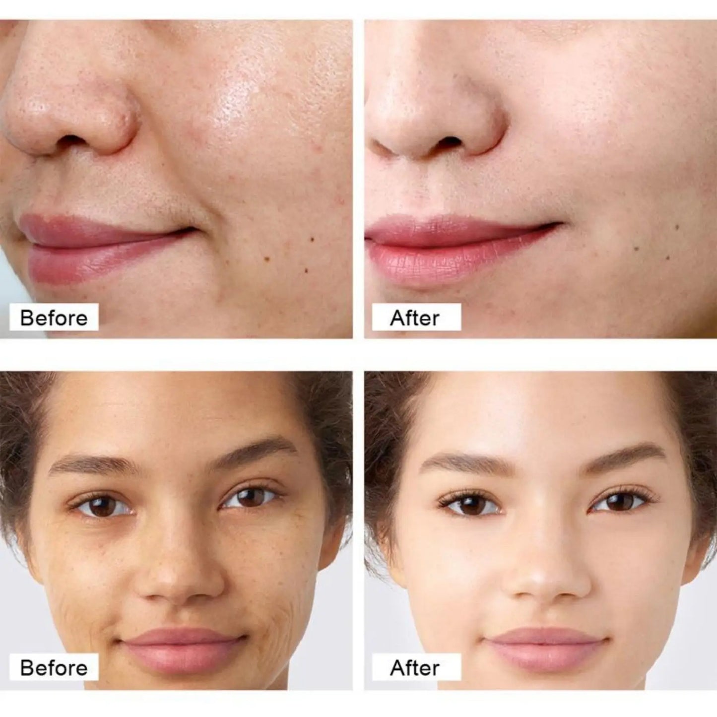 Face Serum Hyaluronic Acid Essence Moisturizing Nursing Snail Nourish Repair Skin Care Korean Beauty Health whitening cream Peaceful Pleasures Health and Wellness