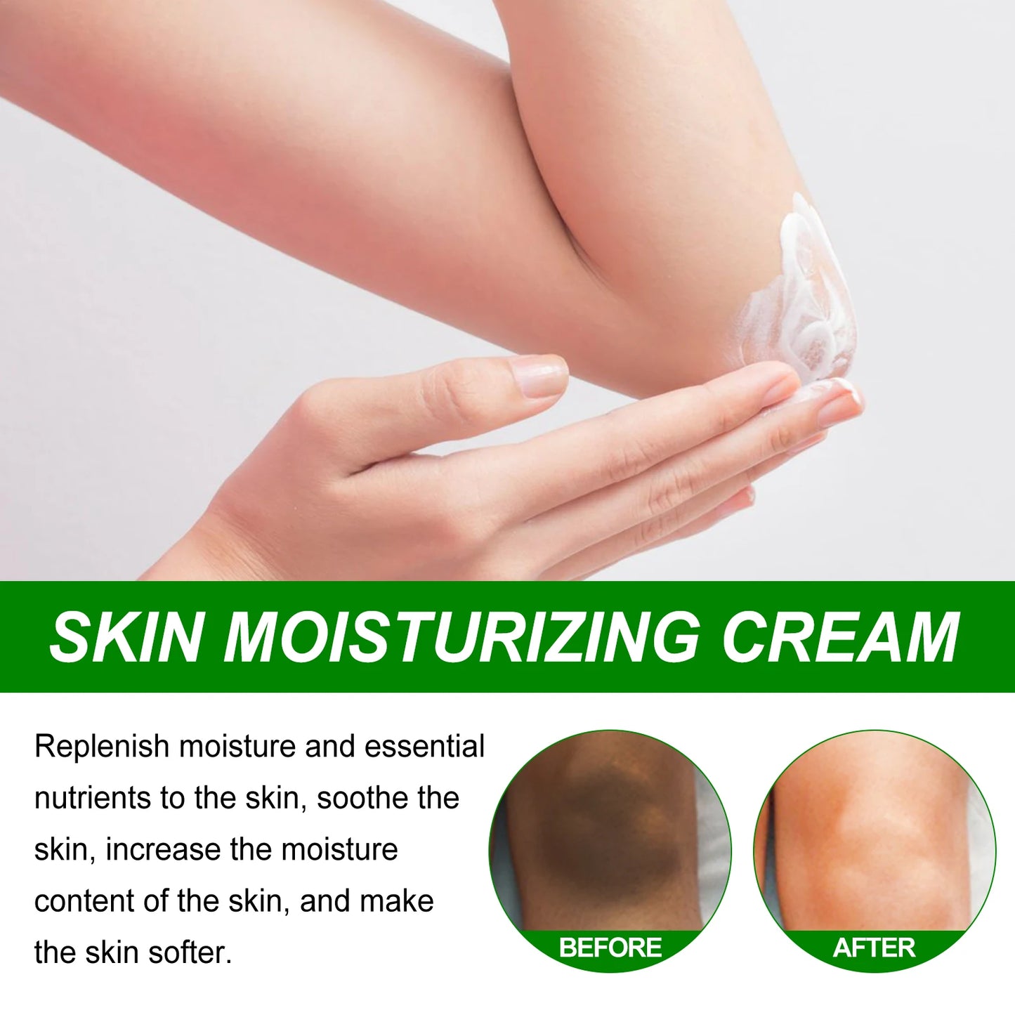 Retinol Body Brightening Cream – Knees, Underarms & Dark Spots