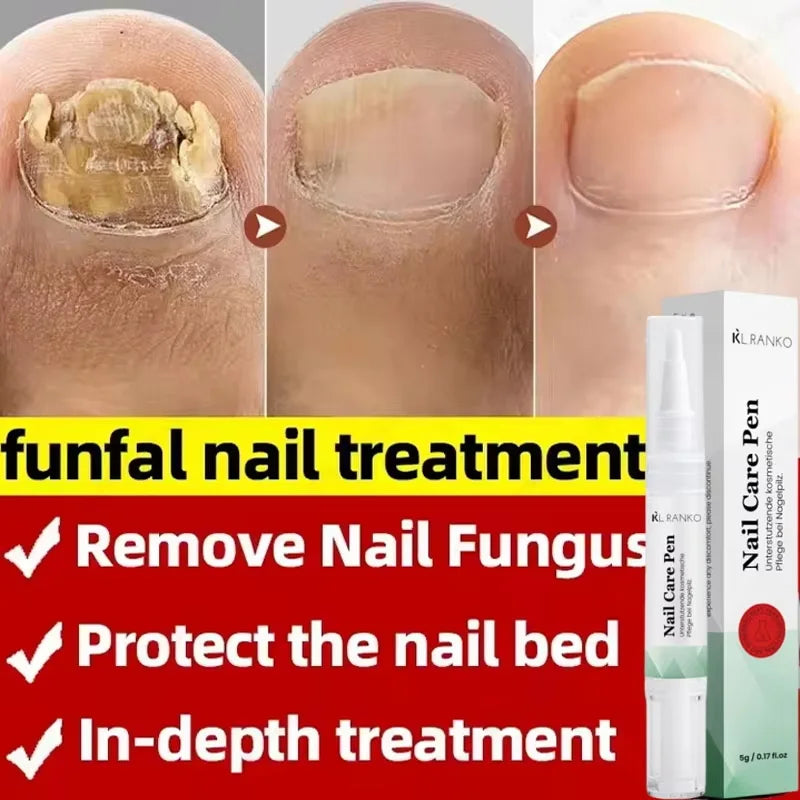 Nail Repair Serum – Foot & Toe Nail Restoration Oil