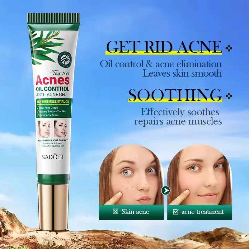 Tea Tree Acne Removing Cream Facial Mild Moisturizing Oil Control Acne Removing Facial Gel Eliminate Acne Pimples Beauty Health Peaceful Pleasures Health and Wellness