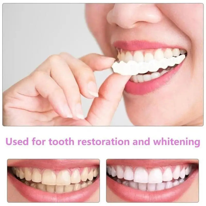 Snap-On Teeth Veneers – Reusable Smile Cover for Men & Women