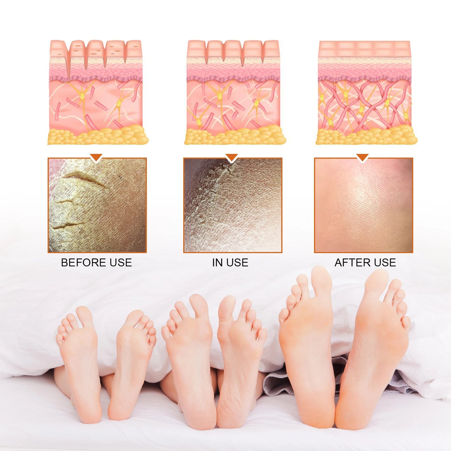 Jaysuing Exfoliating Foot Treatment Spray Remove Dead Skin Care Repair Skin Cracks Replenish Moisture Moisturize Soften Footcare Peaceful Pleasures Health and Wellness