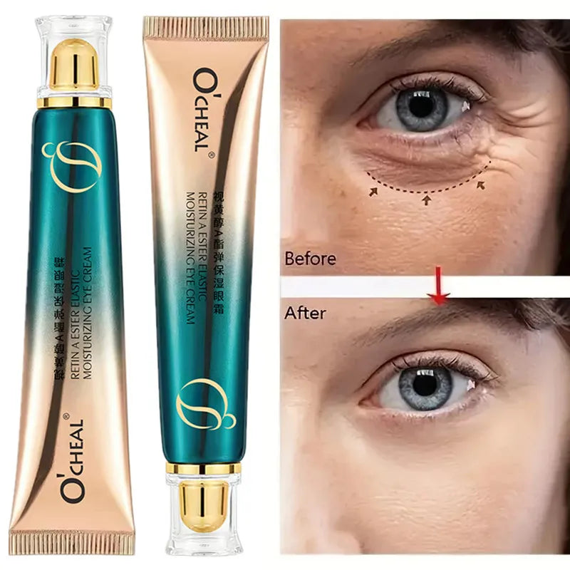 Retinol A Ester Elastic Moisturizing Firming Eye Cream Fading Fine Lines Dark Circles 30g Peaceful Pleasures Health and Wellness