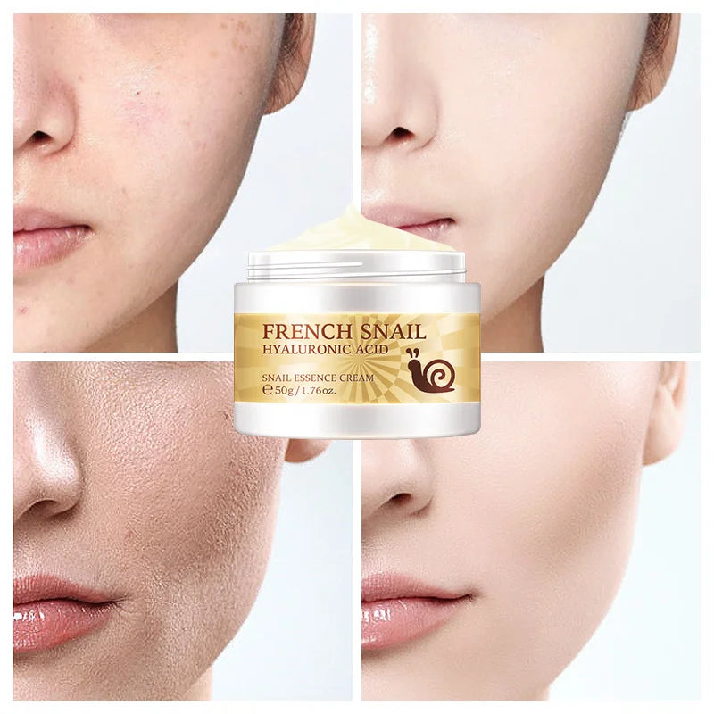 Snail Anti-aging Cream Collagen Remover Wrinkle Fade Fine Lines Repair Face Damaged Lift Firm Smooth Bright Whitening Skin Care Peaceful Pleasures Health and Wellness 50g