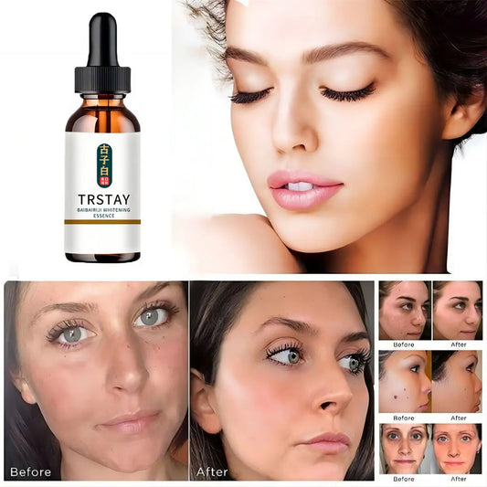 Effective Whitening Serum Remove Dark Spots Freckle Essence Anti-Aging Fade Pigmentation Melasma Brighten Beauty Face Skin Care Peaceful Pleasures Health and Wellness 30ml