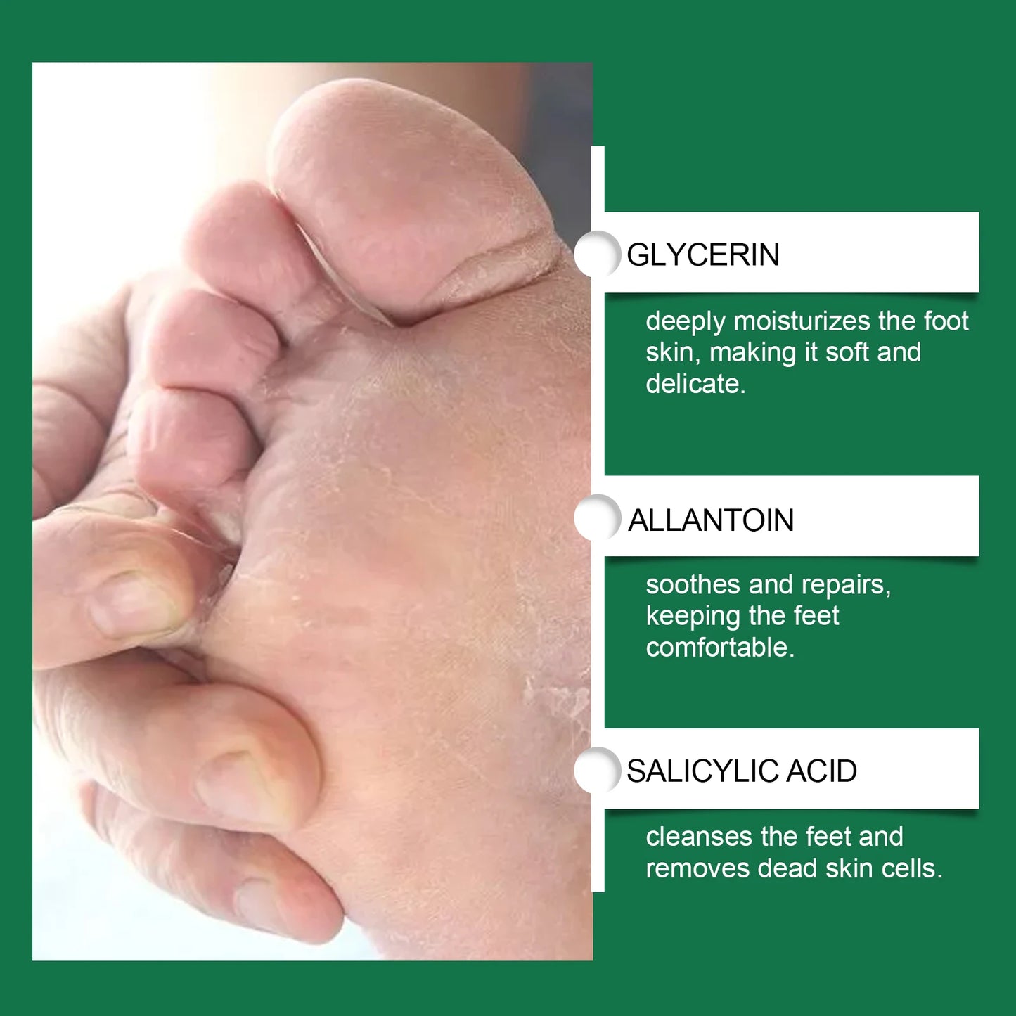 Foot Softening Spray – Exfoliator for Calluses & Rough Skin