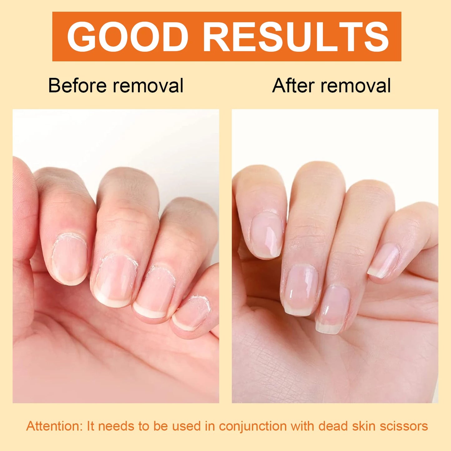 15ml Cuticle Remover Cream Nail Care，Hydrating，Moisturizing，Cuticle Dead Skin Softener For Dry Manicures，Brittle Nails，Dry Cutic Peaceful Pleasures Health and Wellness