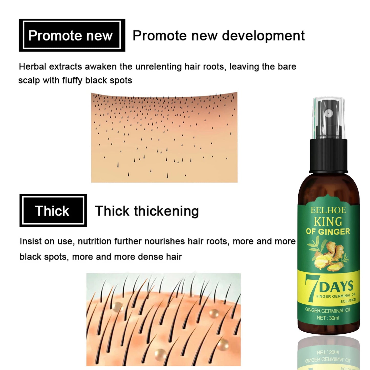 Ginger Root Scalp Serum Spray – Nourishing Mist for Dry Frizzy Hair