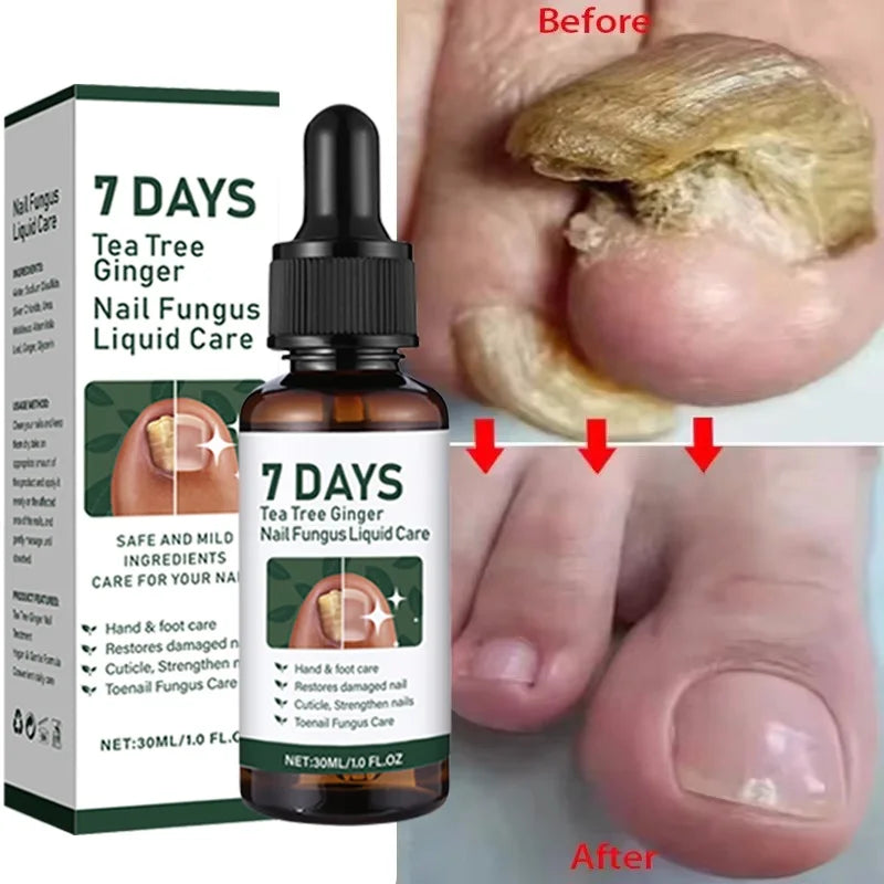 Eelhoe Nail Repair Serum – Ginger Extract for Healthy Nails