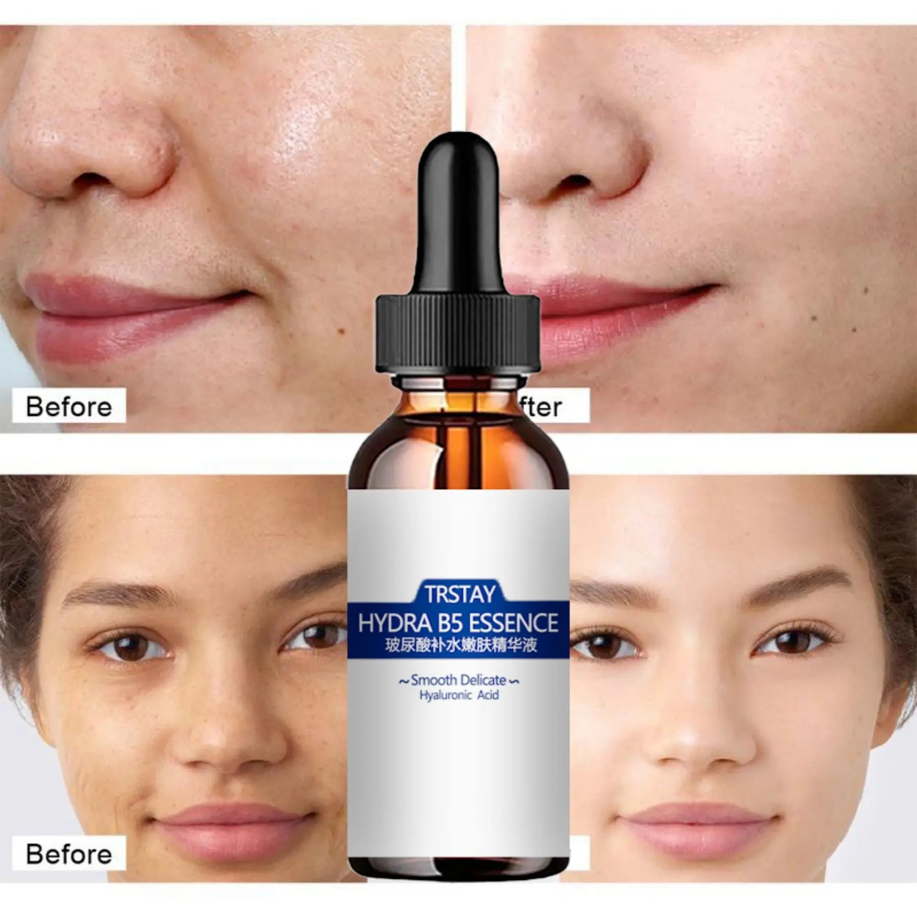 Face Serum Hyaluronic Acid Essence Moisturizing Nursing Snail Nourish Repair Skin Care Korean Beauty Health whitening cream Peaceful Pleasures Health and Wellness 30ml
