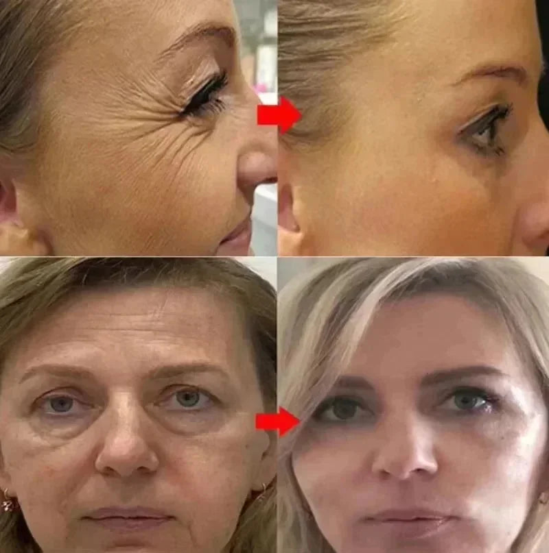Facial Retinol Serum Whitening Moisturising Fade Fine Lines Anti Wrinkle Anti Ageing Rejuvenate Your Face Korean Cosmetics 30ml Peaceful Pleasures Health and Wellness