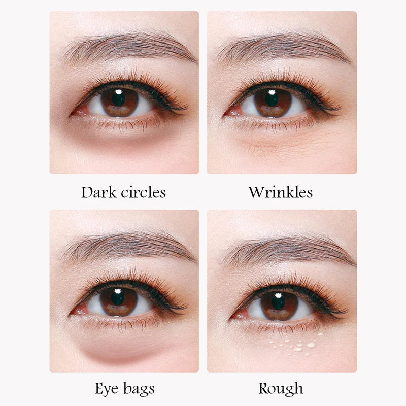 Crystal Collagen Eye Patches – Dark Circles & Wrinkles