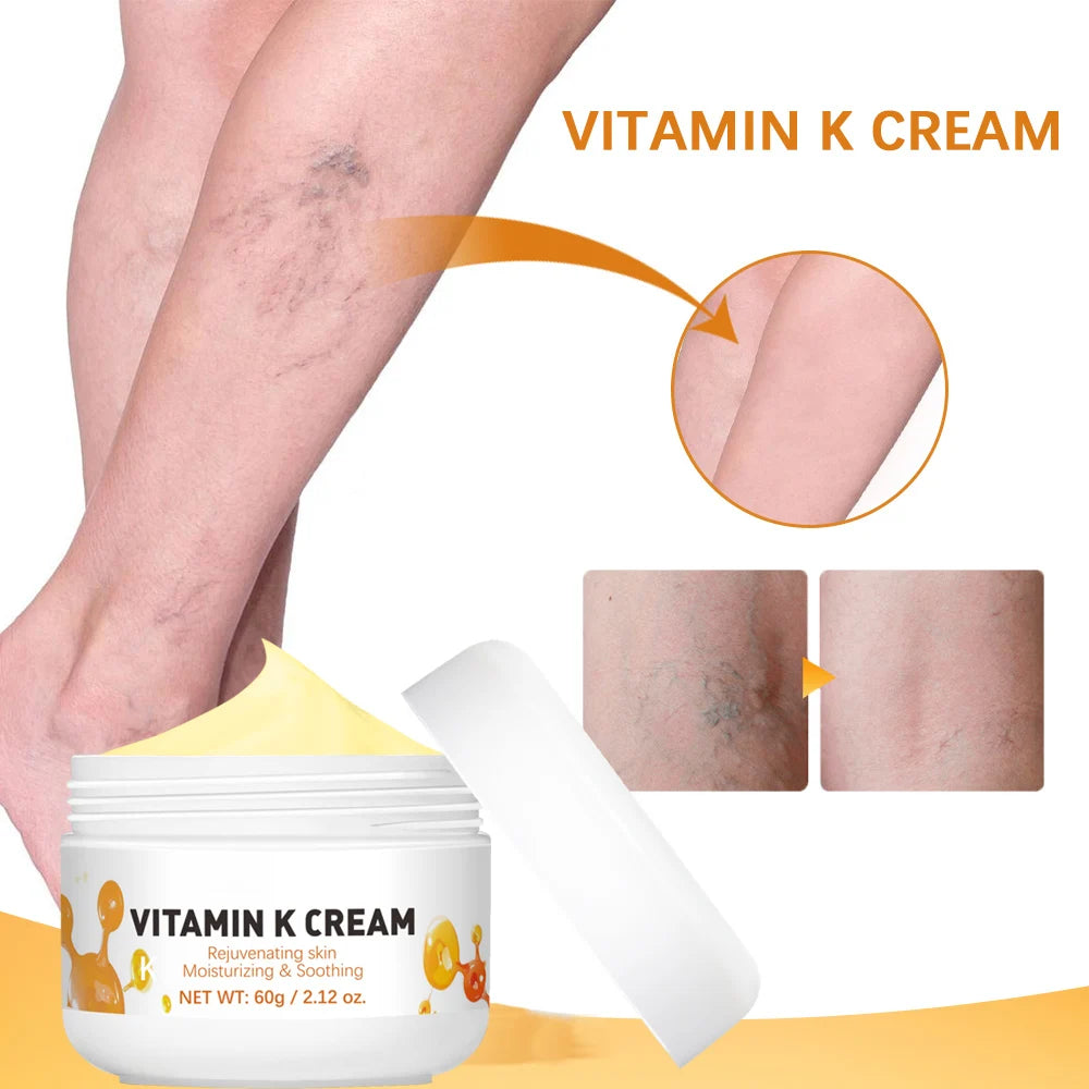 Vitamin K Cream Anti-aging And Wrinkle Removal Varicose Vein Relief Cream Massage Care Relieve Leg Soreness Swelling Ointment Peaceful Pleasures Health and Wellness