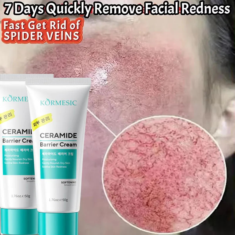 SADOER Soothing Face Cream – Sensitive Skin Moisturizer