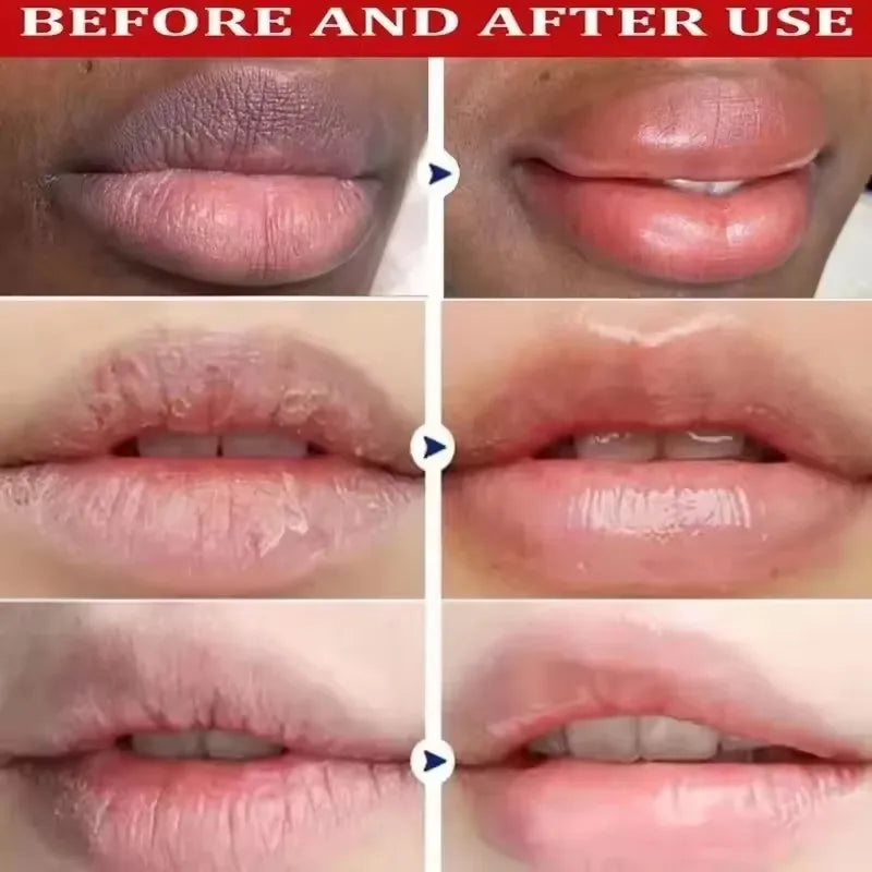 Remove Dark Rose Lip Balm Serum Lighten Melanin Lip Mask Exfoliating Fade Lip Lines Dead Skin Nourishing Repair Lip Care Makeup Peaceful Pleasures Health and Wellness