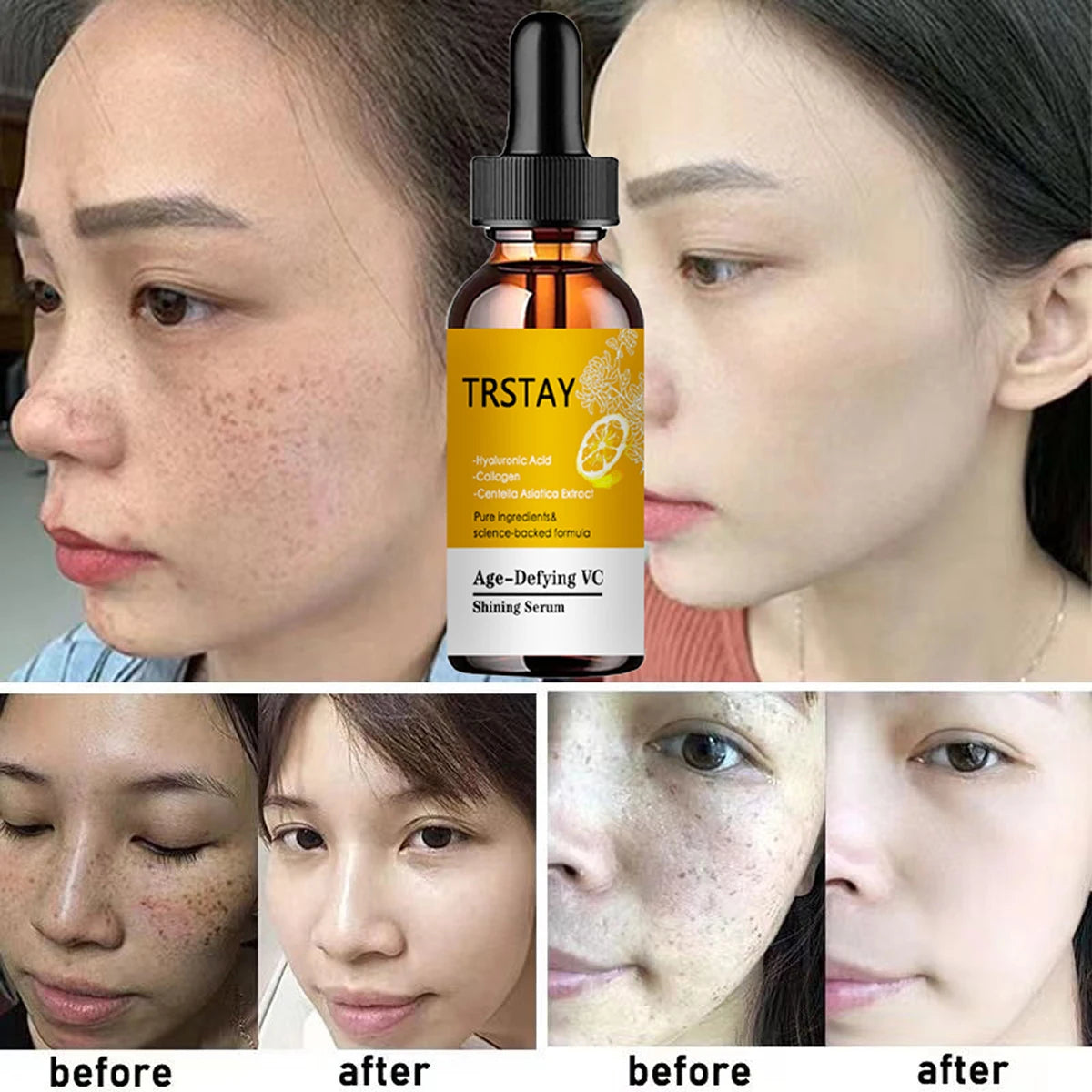 Vitamin C Serum Face Glowing Dark Spot Remover Skincare Moisturizer Wrinkle Remove Anti Aging Facial Serum Korean Cosmetics Peaceful Pleasures Health and Wellness