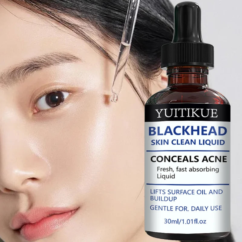YUITIKUE Blackhead Remover Liquid Gentle Acne Oil Control Deep Cleansing Pore Refining Skin Care Peaceful Pleasures Health and Wellness