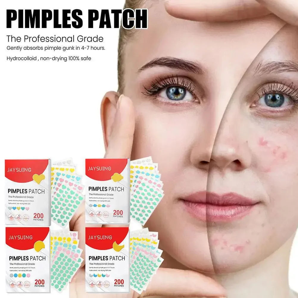200pcs Hydrocolloid Acne Patch Facial Skin Care Repair Fade Blemishes Pimple Zots Closed Acne Blemishes Cover Acne Pimple Patch Peaceful Pleasures Health and Wellness