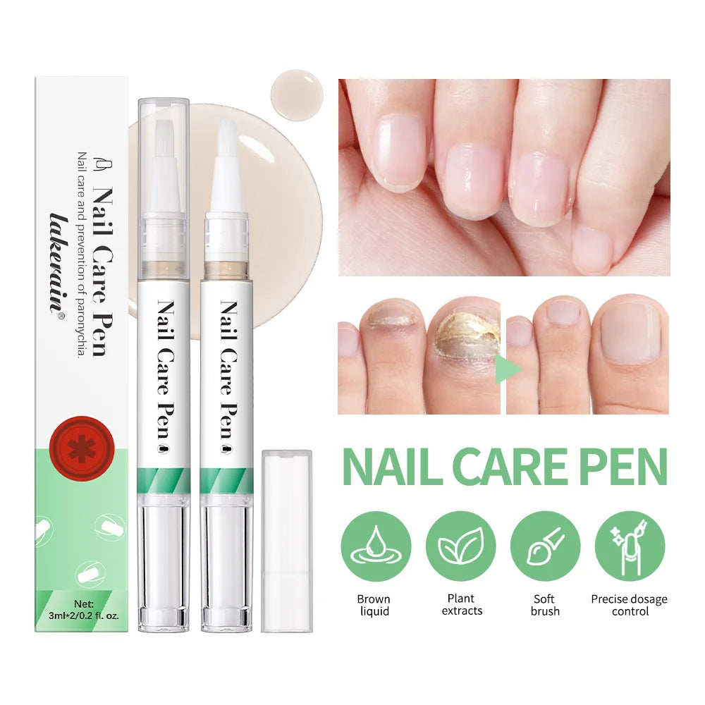 Nail Growth Oil Nail Treatment Cuticle Revitalizer Oil Prevent Agnail Nail Polish Nail Nutrition Oil Pen Manicure Nail Repair Peaceful Pleasures Health and Wellness