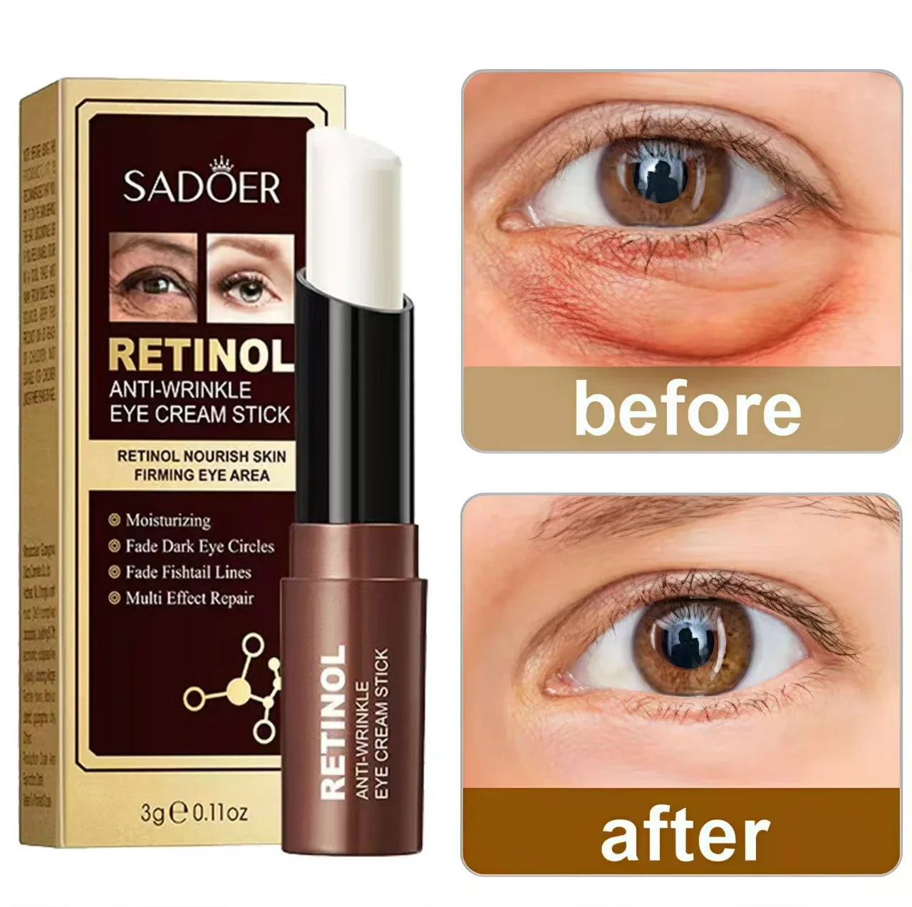 Retinol Eye Cream – Dark Circles, Fine Lines & Wrinkles