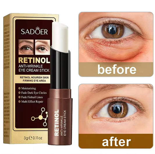 Retinol Eye Cream – Dark Circles, Fine Lines & Wrinkles Retinol Eye Cream Oasis Select