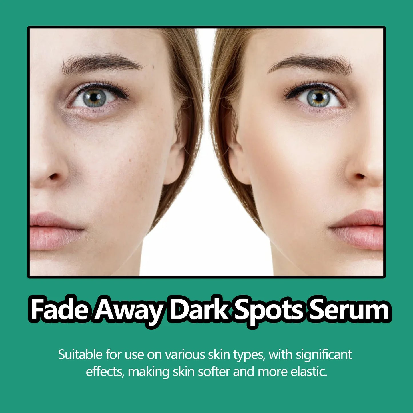 Dark Spots Treatment Serum Fade Acne Marks Remove Melasma Anti Pigmentation Whitening Freckle Nourishing Pores Shrinking Essence Peaceful Pleasures Health and Wellness