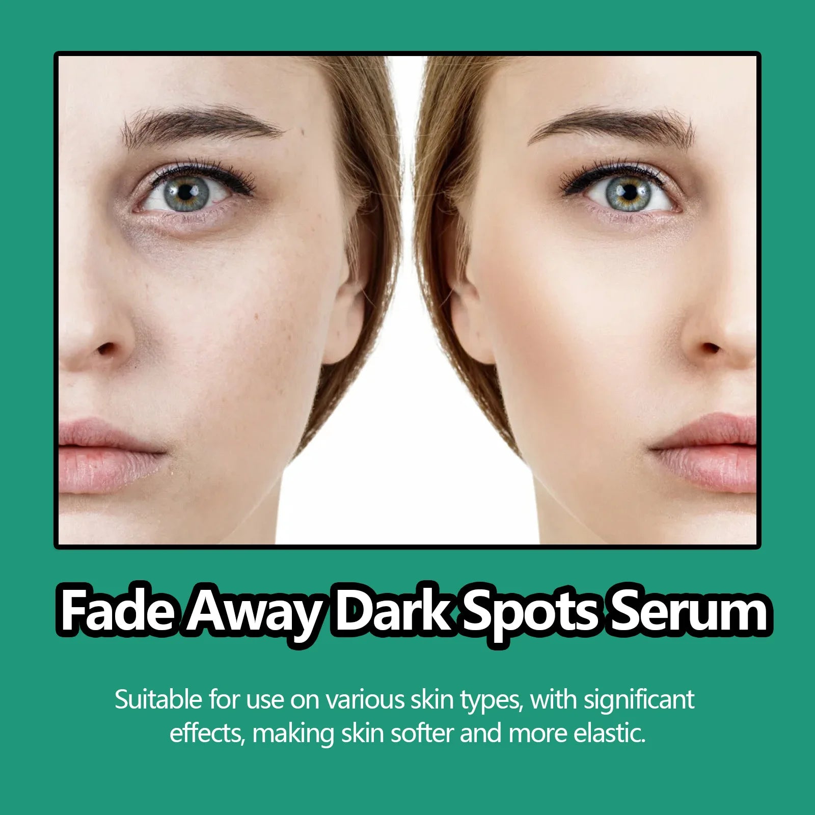 Dark Spots Treatment Serum Fade Acne Marks Remove Melasma Anti Pigmentation Whitening Freckle Nourishing Pores Shrinking Essence Peaceful Pleasures Health and Wellness
