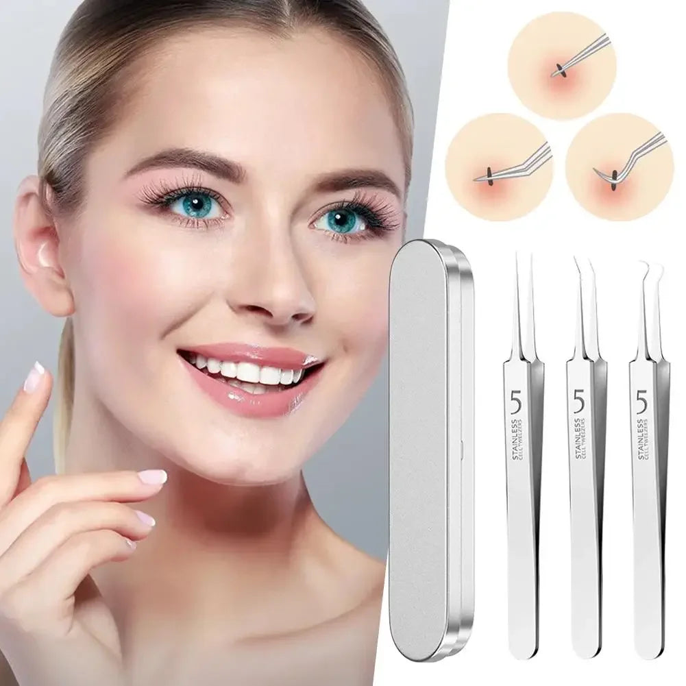Professional Facial Blackhead Remover Tweezers,3Pcs Precision Pimple Popper Tool Kit for Whitehead Ance Blemishs Comedones Peaceful Pleasures Health and Wellness