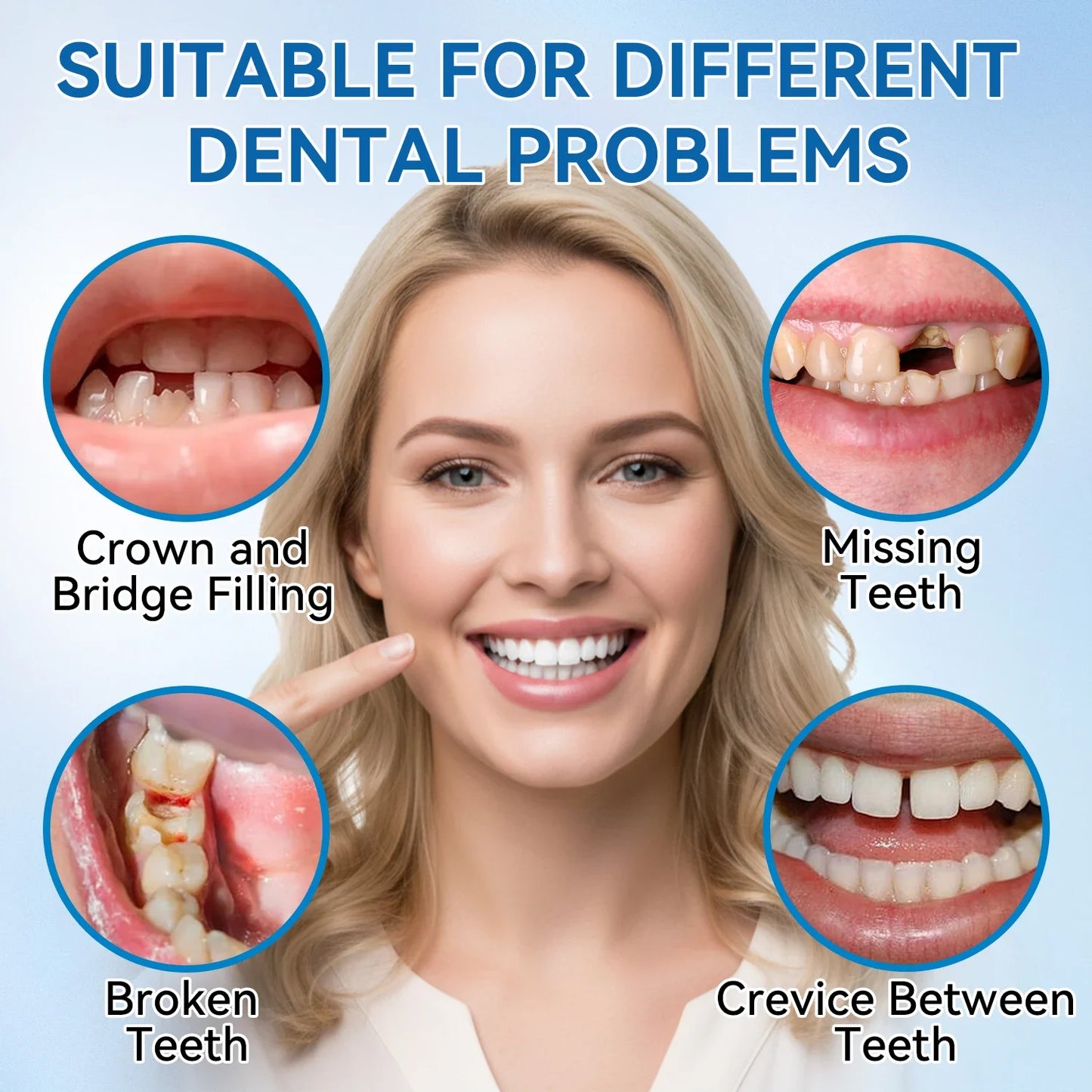 Instant Temporary Fake Teeth – Moldable Cosmetic Dental Kit