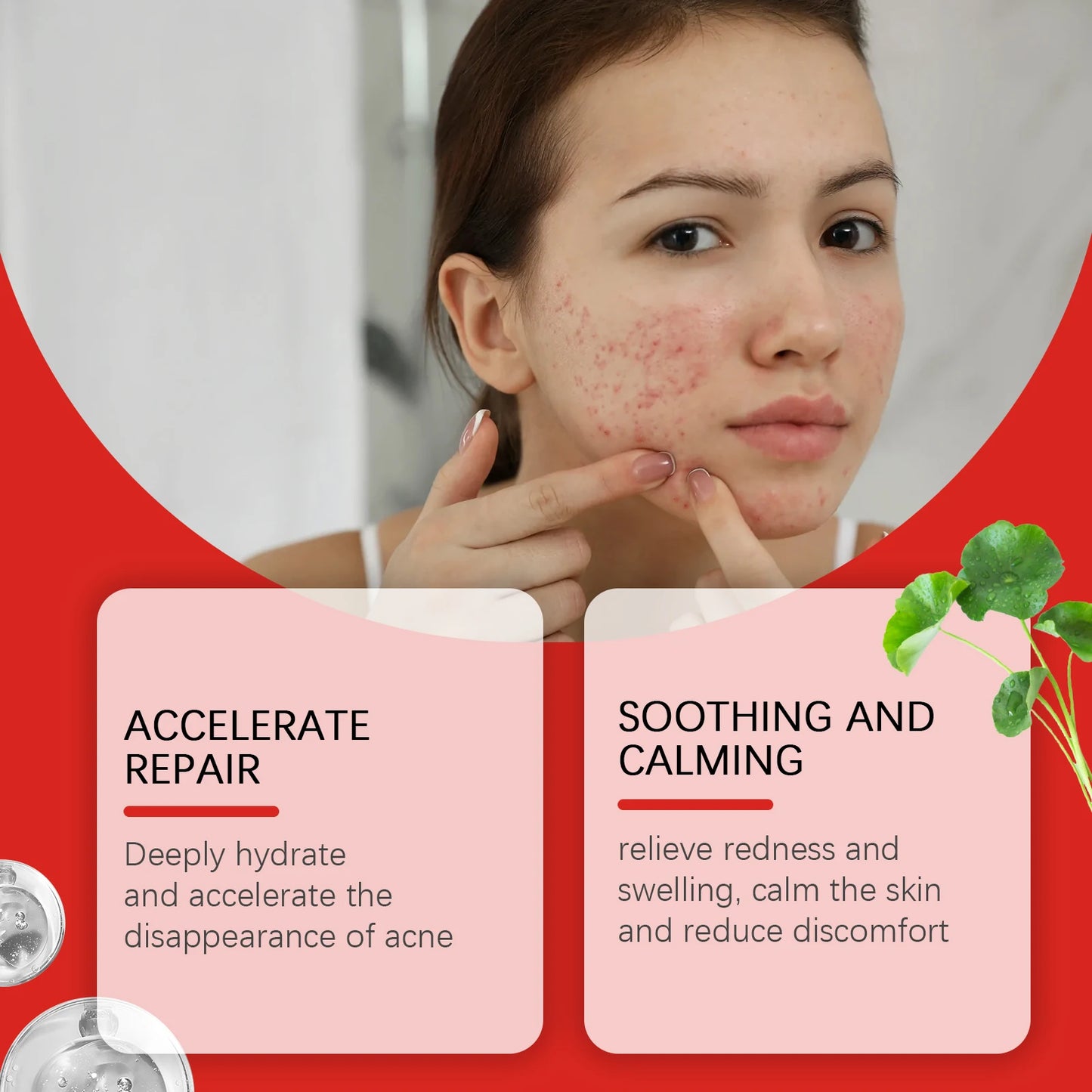240-Pack Salicylic Acid Acne Patches – Cute Fun Shapes