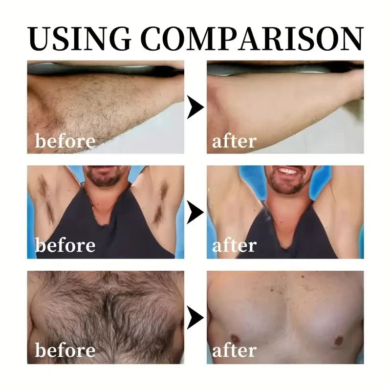 SADOER 3-Min Hair Removal Cream | Face, Body & Intimate Areas