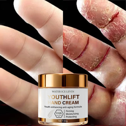 YouthLift Hand Cream with HA & Retinol – Firm & Moisturize Anti-Aging Hand Cream Oasis Select