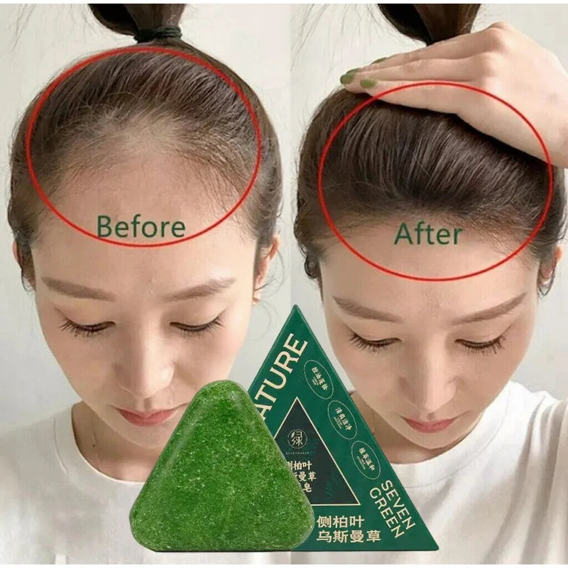 Arborvitae Leaf Shampoo Soap Handmade Natural Herbal Scalp Itching Relief Promote Hair Growth Prevent Hair Loss And DandruffSoap Peaceful Pleasures Health and Wellness