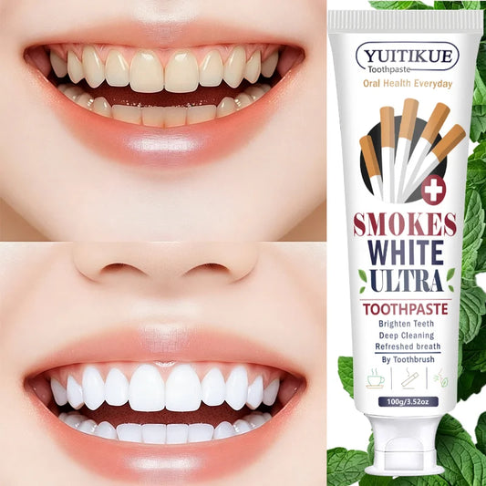 Yuitikue Smokes White Ultra Toothpaste, 100g Effective Stain Removal Toothpaste for Brighter Teeth & Fresh Breath, Deep Cleaning Peaceful Pleasures Health and Wellness