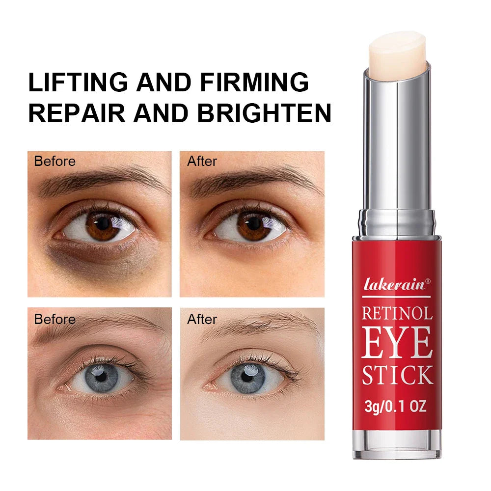 Lakerain Retinol Eye Cream – Firming, Brightening & Hydrating