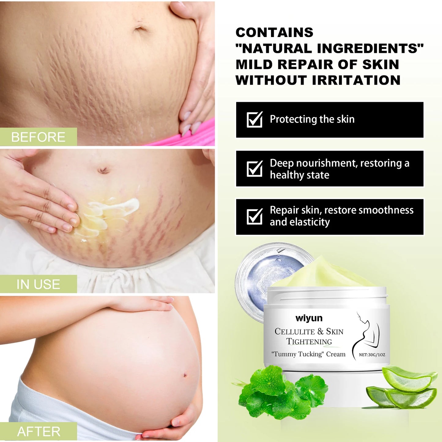 WIYUN Stretch Mark Cream – Firm, Repair & Smooth Skin 30g