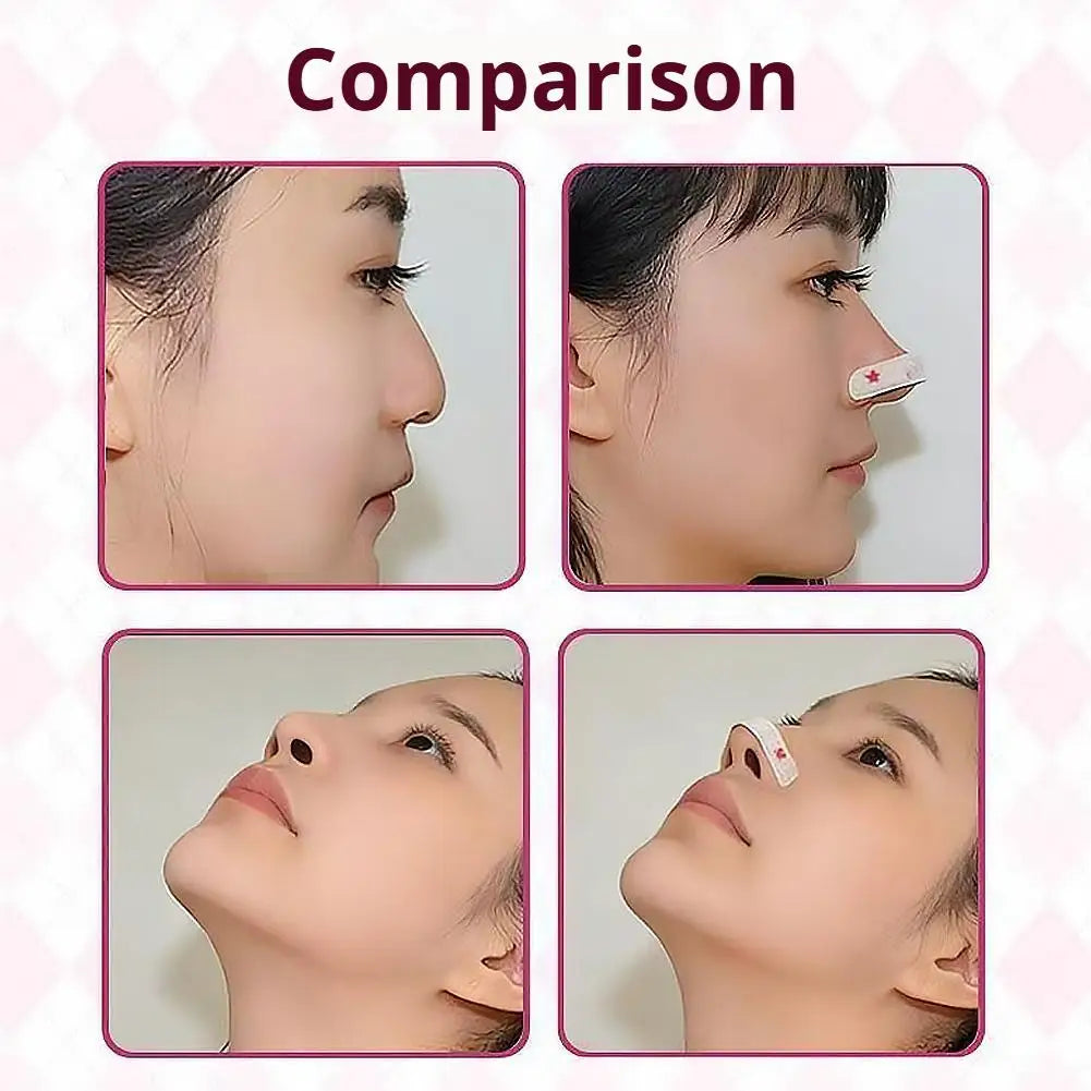 Reusable Nose Lift Strips – Reshaping & Contouring Tape