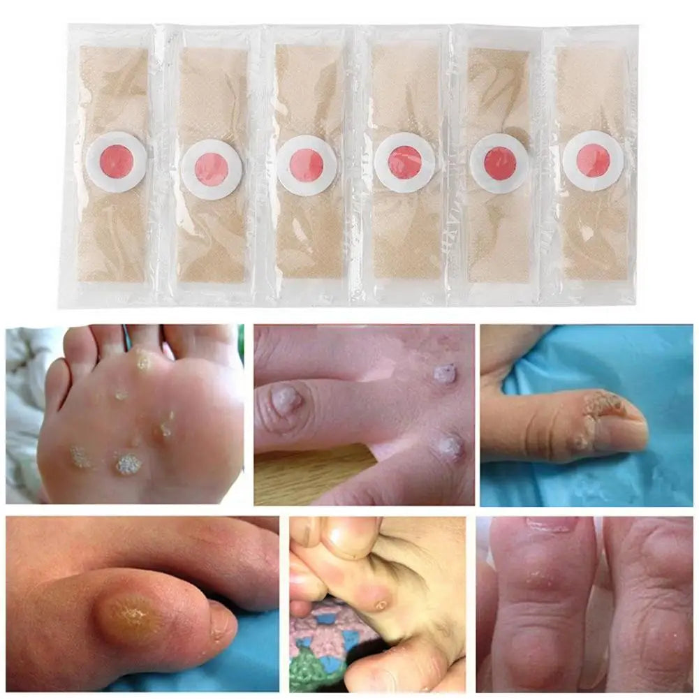 6PCS Corn Remover Plaster, Adhesive Foot Corn Callus Removal Pads for Foot Care Corns Callus Feet Sore Shoes Sticker Self Adhesi Peaceful Pleasures Health and Wellness