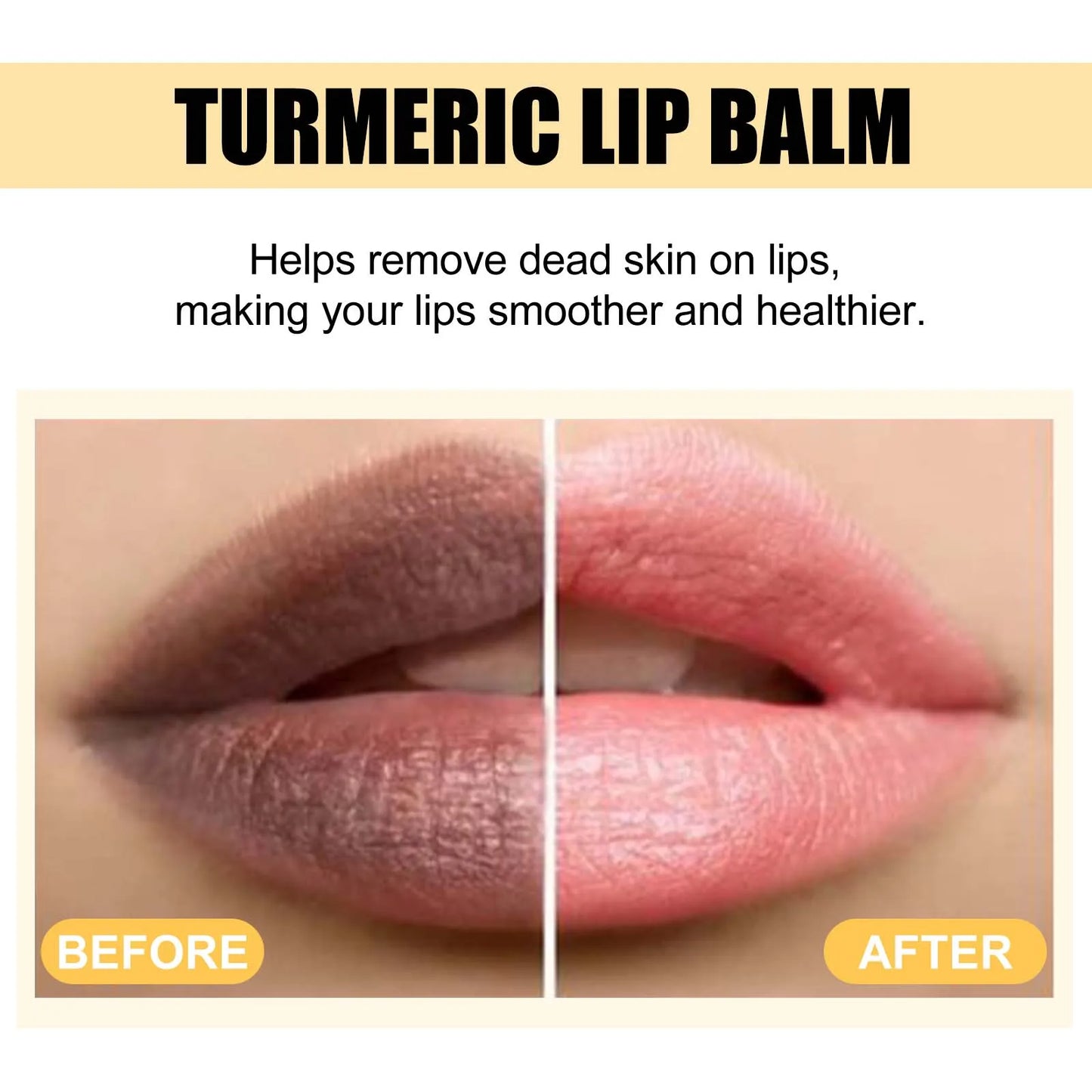 Eelhoe Turmeric Lip Balm – Darkness Removal & Moisturizing
