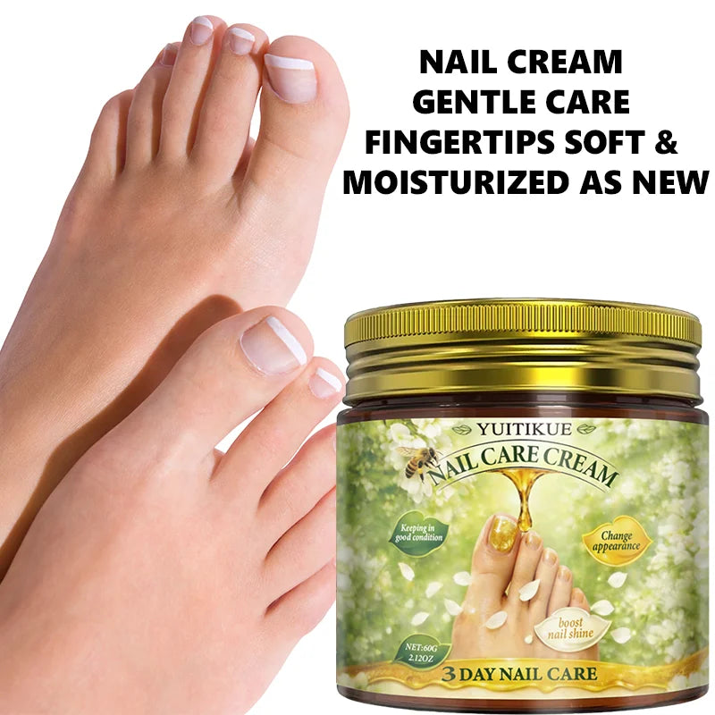 Yuitikue 3 Day Nail Care Cream, 60g Nail Repair Cream to Boost Nail Shine, Improve Nail Condition & Appearance Peaceful Pleasures Health and Wellness