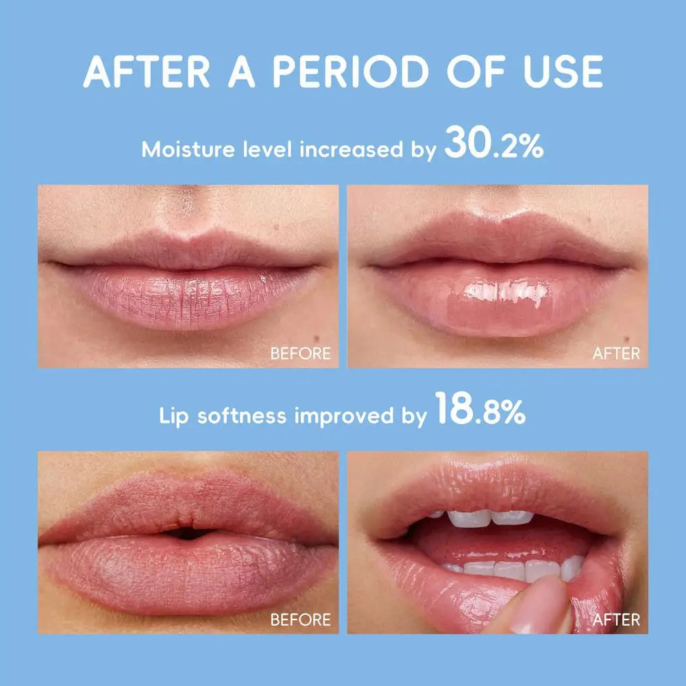 Milk Nourishing Lip Balm – Shea Butter & Hyaluronic Acid