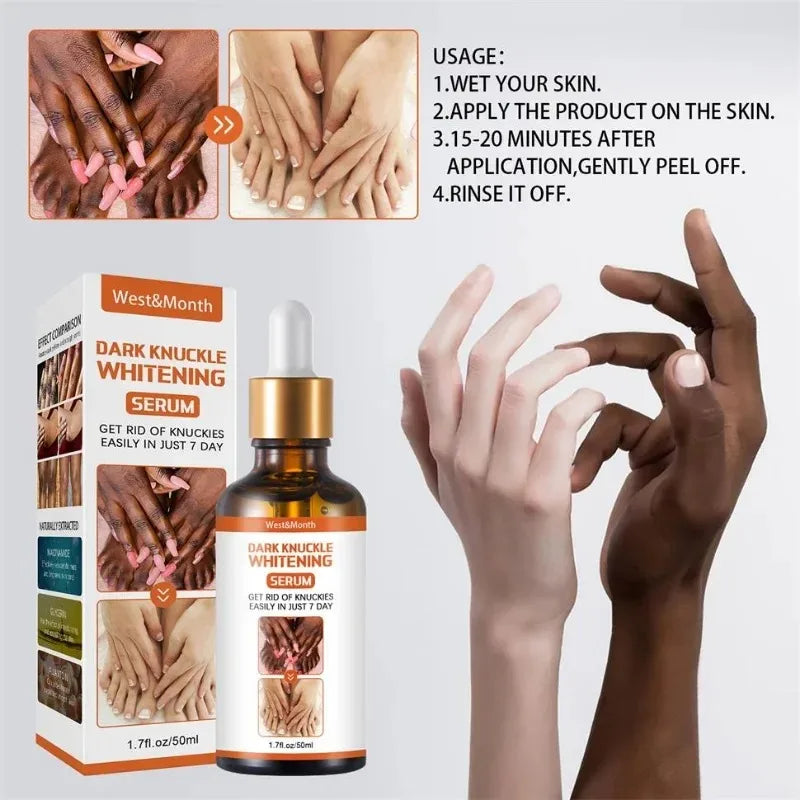 LGRAMER Whitening Essence for Dark Knuckles, Elbows & Knees