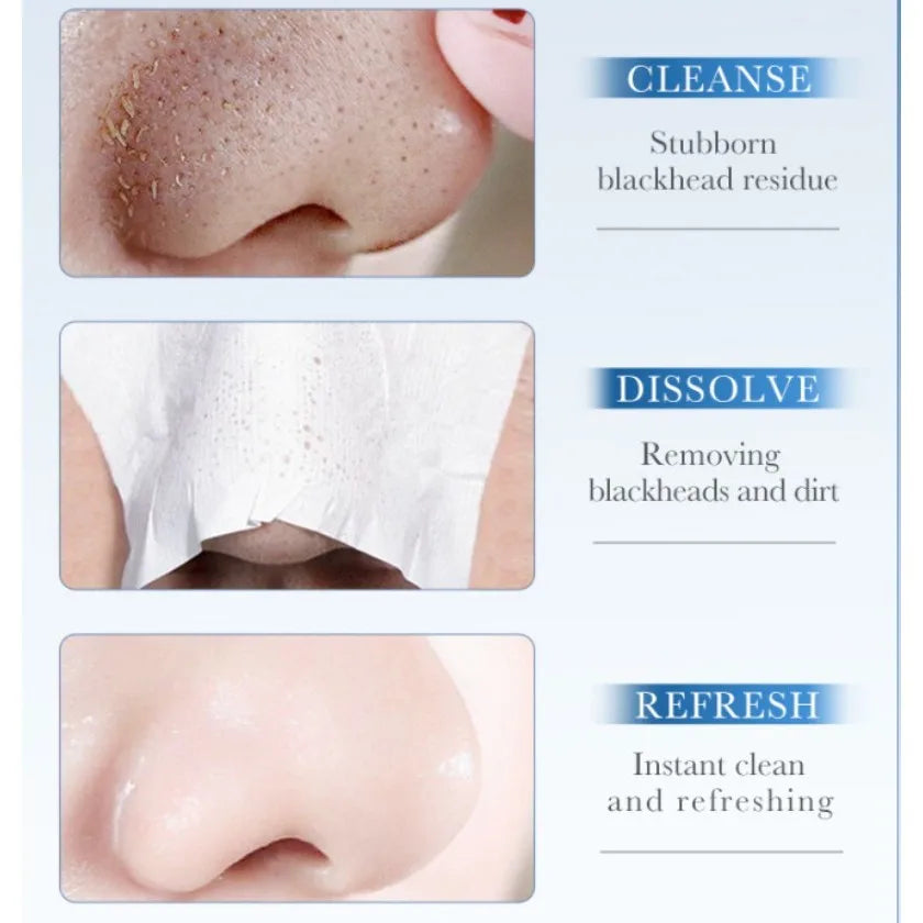 SADOER Blackhead Remover Nose Mask Shrink Pores Improve acne Deep Nose Cleansing Skin Care Peaceful Pleasures Health and Wellness