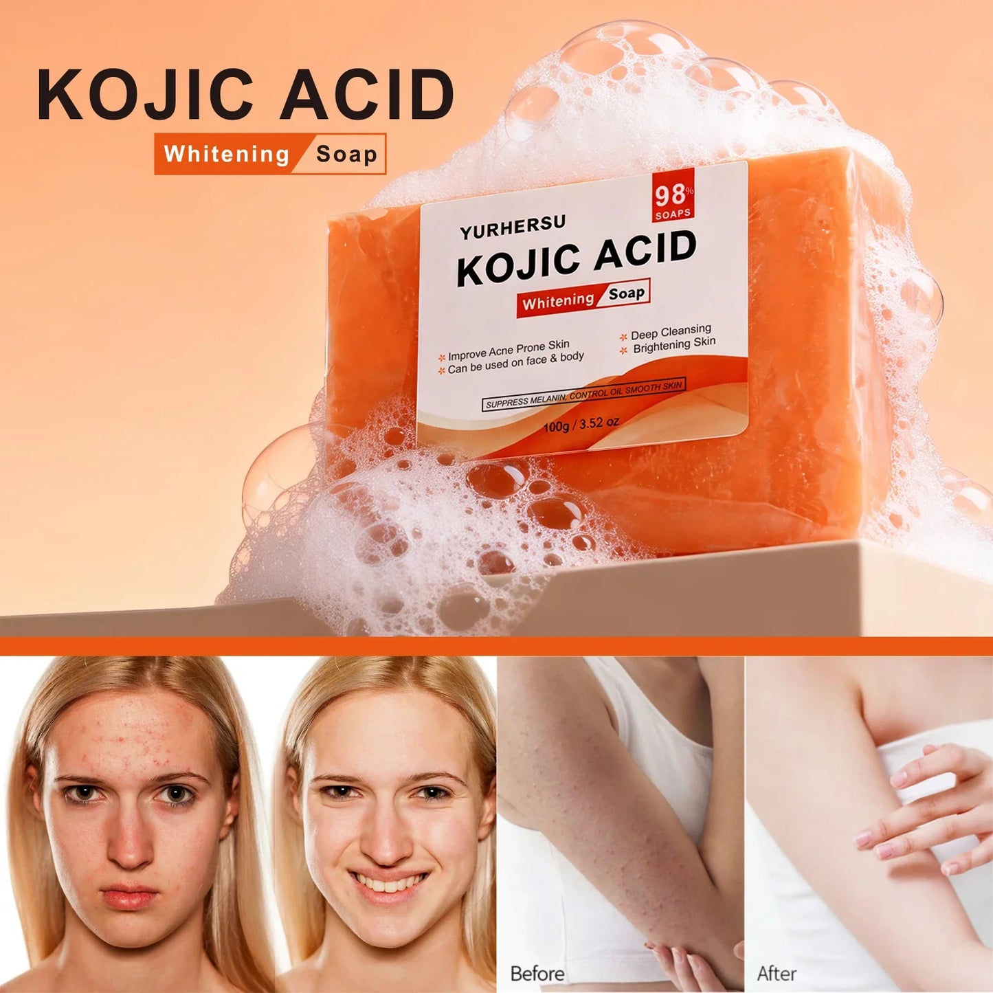 Kojic Acid Brightening Face Soap – Natural Moisturizing Cleanser