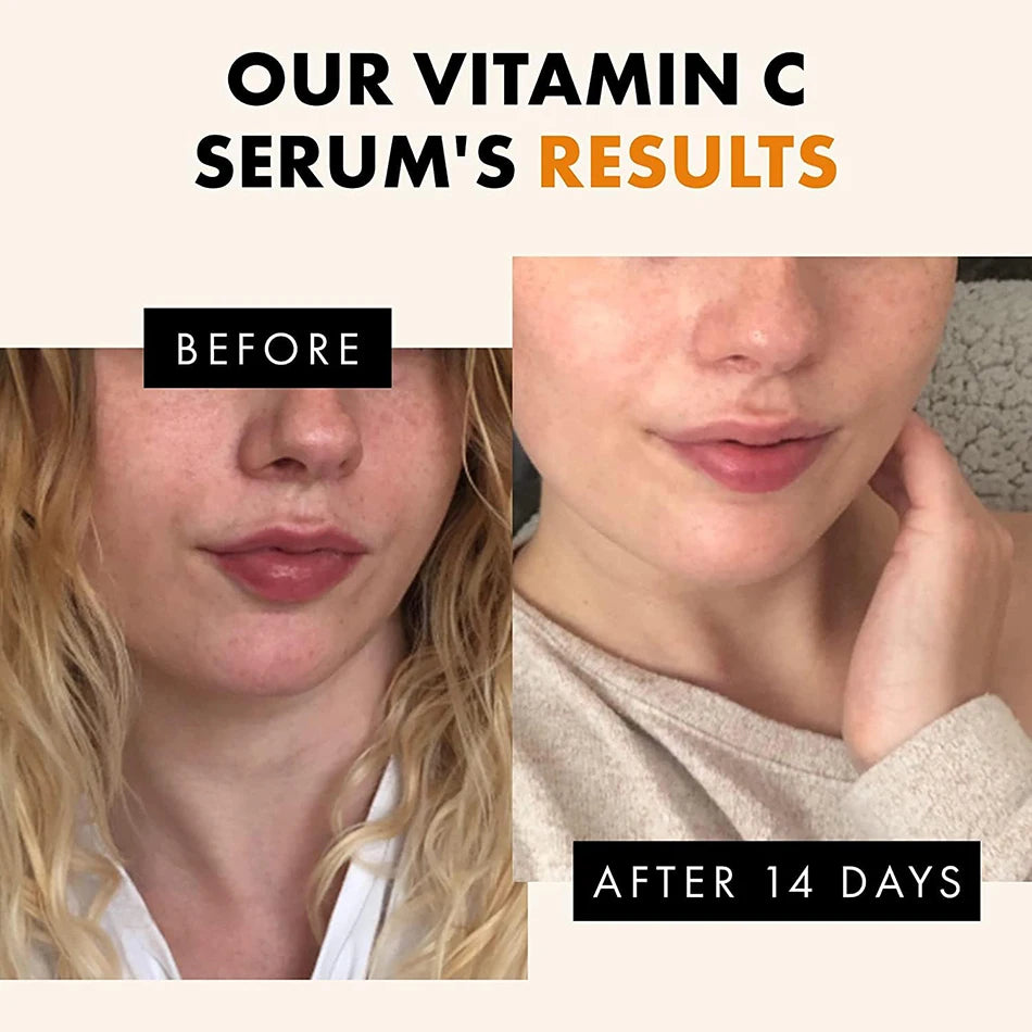 120ml 99% Vitamin C Serum Oil Facial Serum AHA Kojic Acid glutathione Facial skin brightening Peaceful Pleasures Health and Wellness