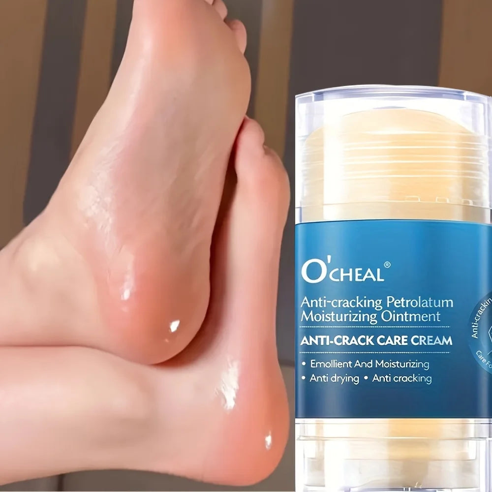 Anti-Crack Foot Cream for Dry & Cracked Heels – Moisturizer
