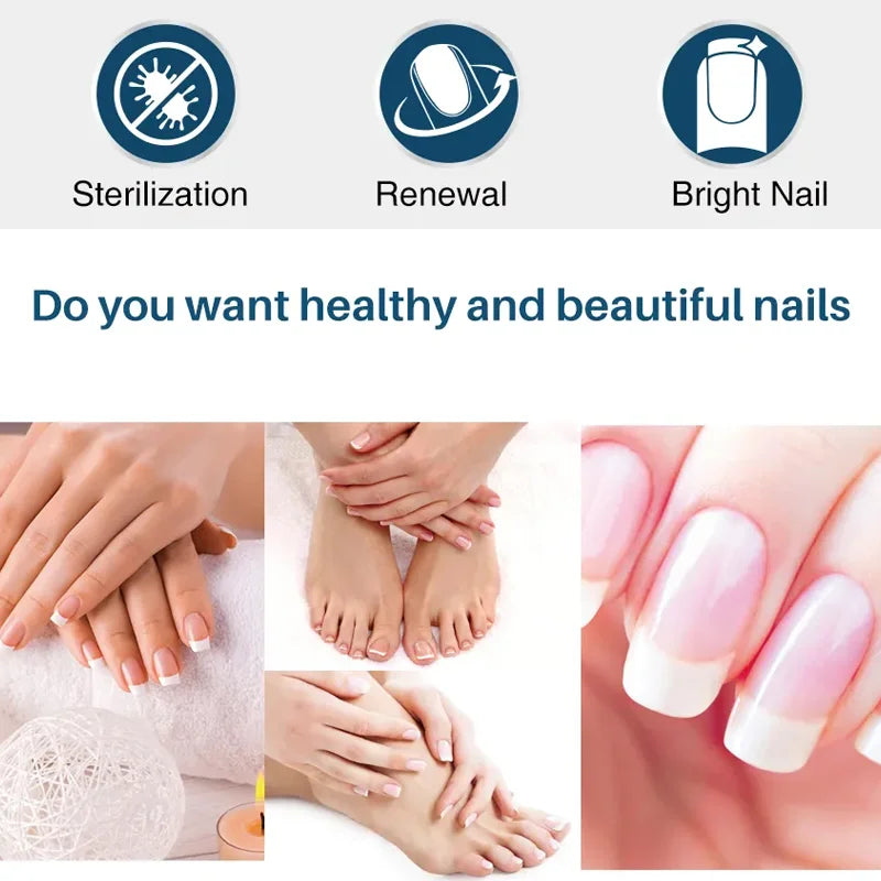 YUITIKUE Ginger King Nail Cream – 7-Day Nail Care, 60g Nail Treatment Cream Peaceful Pleasures Health and Wellness