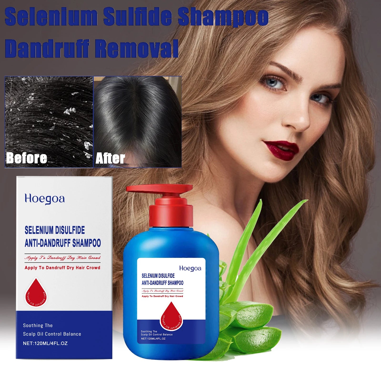 Selenium Sulfide Hair Shampoo Deep Cleansing Scalp Remove Dandruff Refreshing Strengthen Hair Roots Smoothing Soften Shiny Hair Peaceful Pleasures Health and Wellness