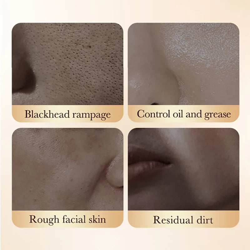 White Rice Face Peeling Mask | Blackhead Removal & Anti-Aging