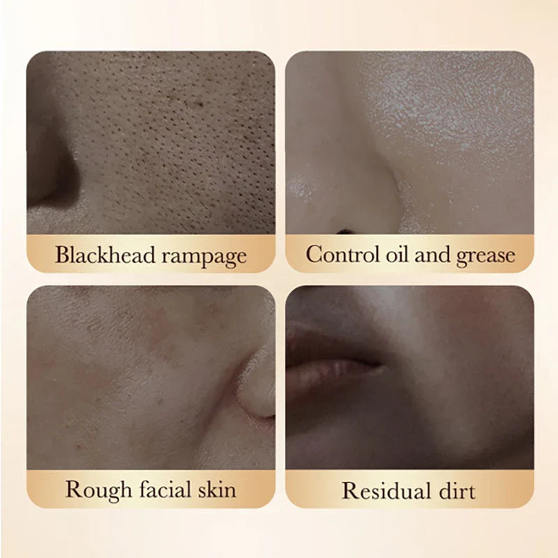 White Rice Face Peeling Mask – Blackhead Removal & Anti-Aging